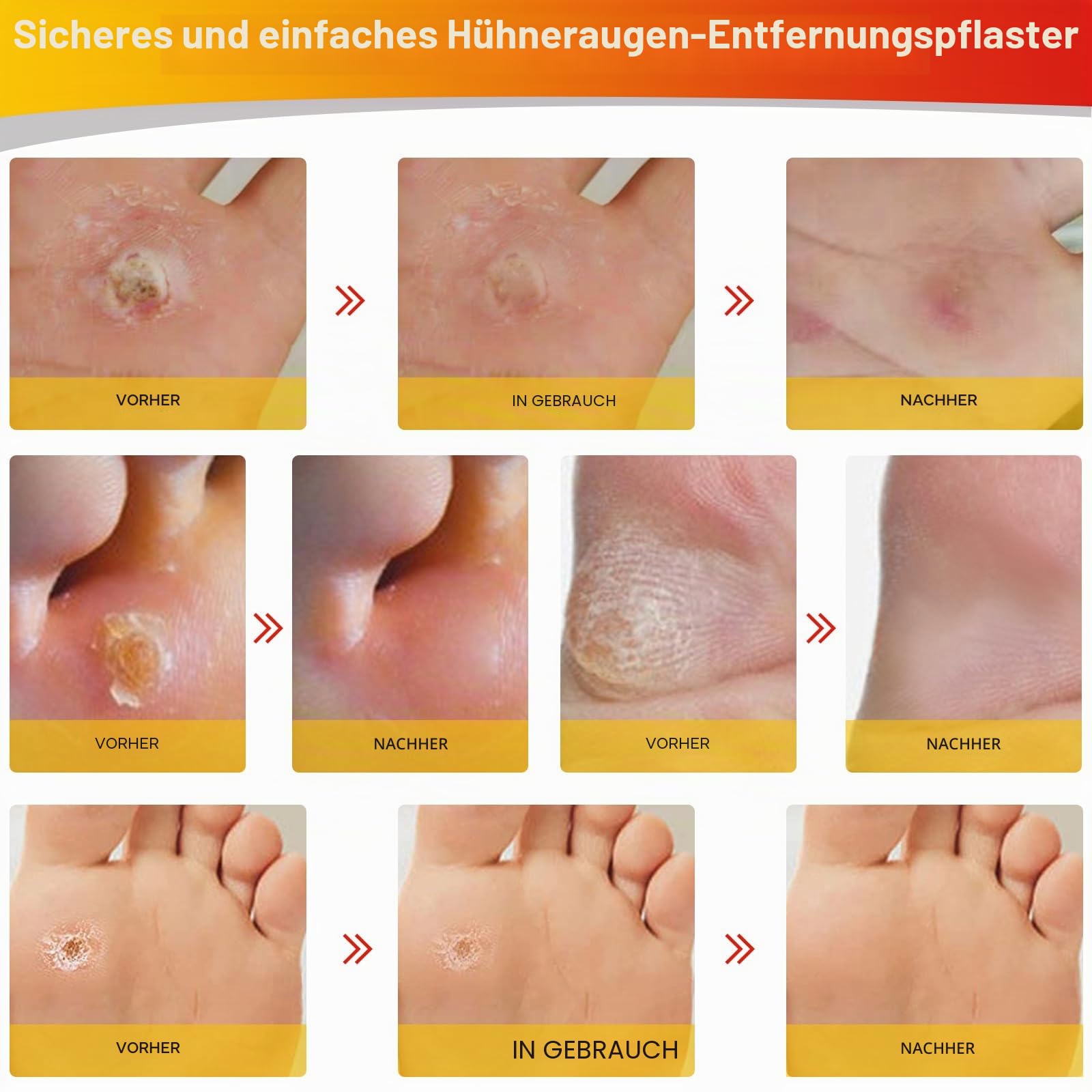 mymulike-health-care-h-hneraugenpflaster-24-st-2-gr-en image 5