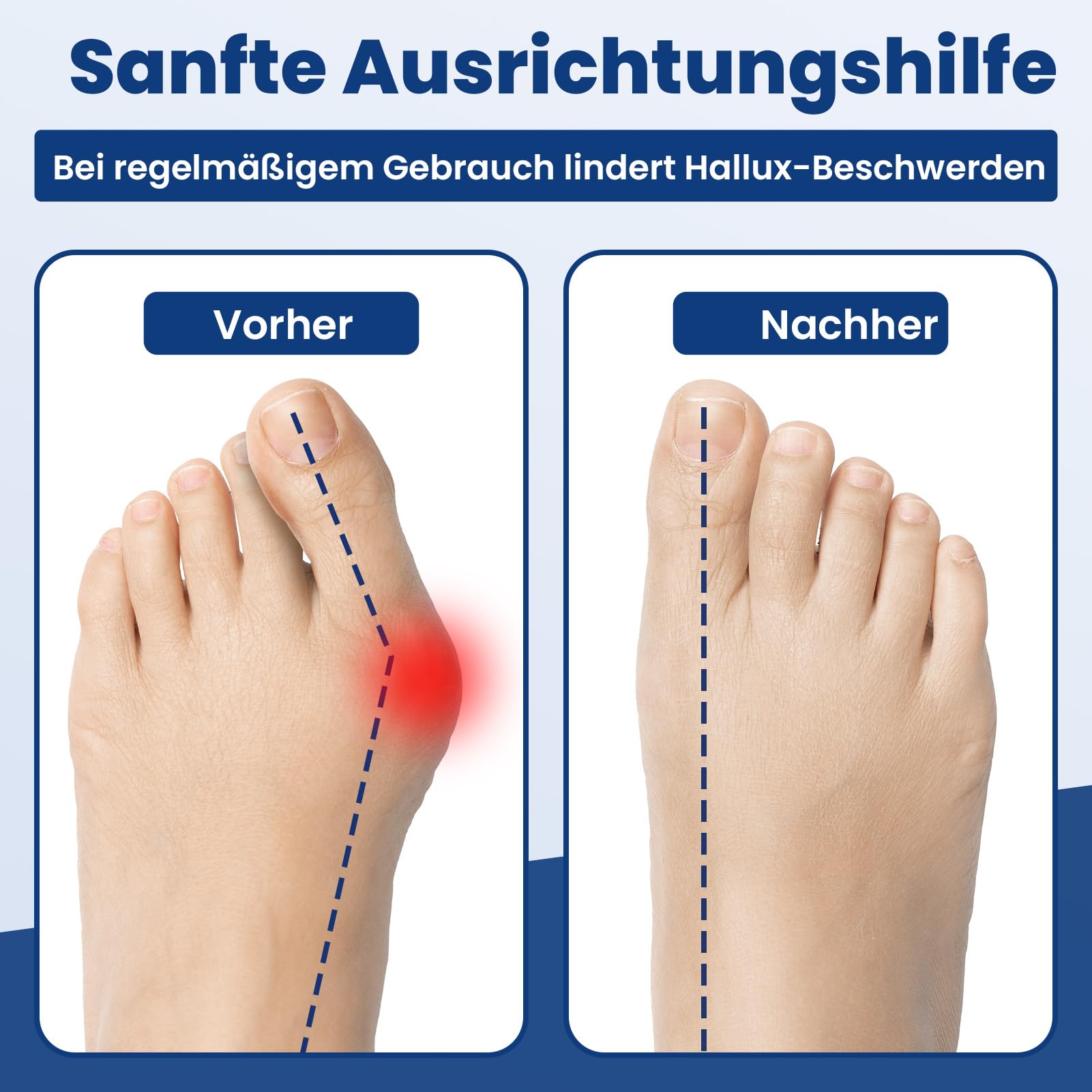 anjocare-hornhautentferner-hallux-valgus-trainingsb-nder-3er-pack image 5
