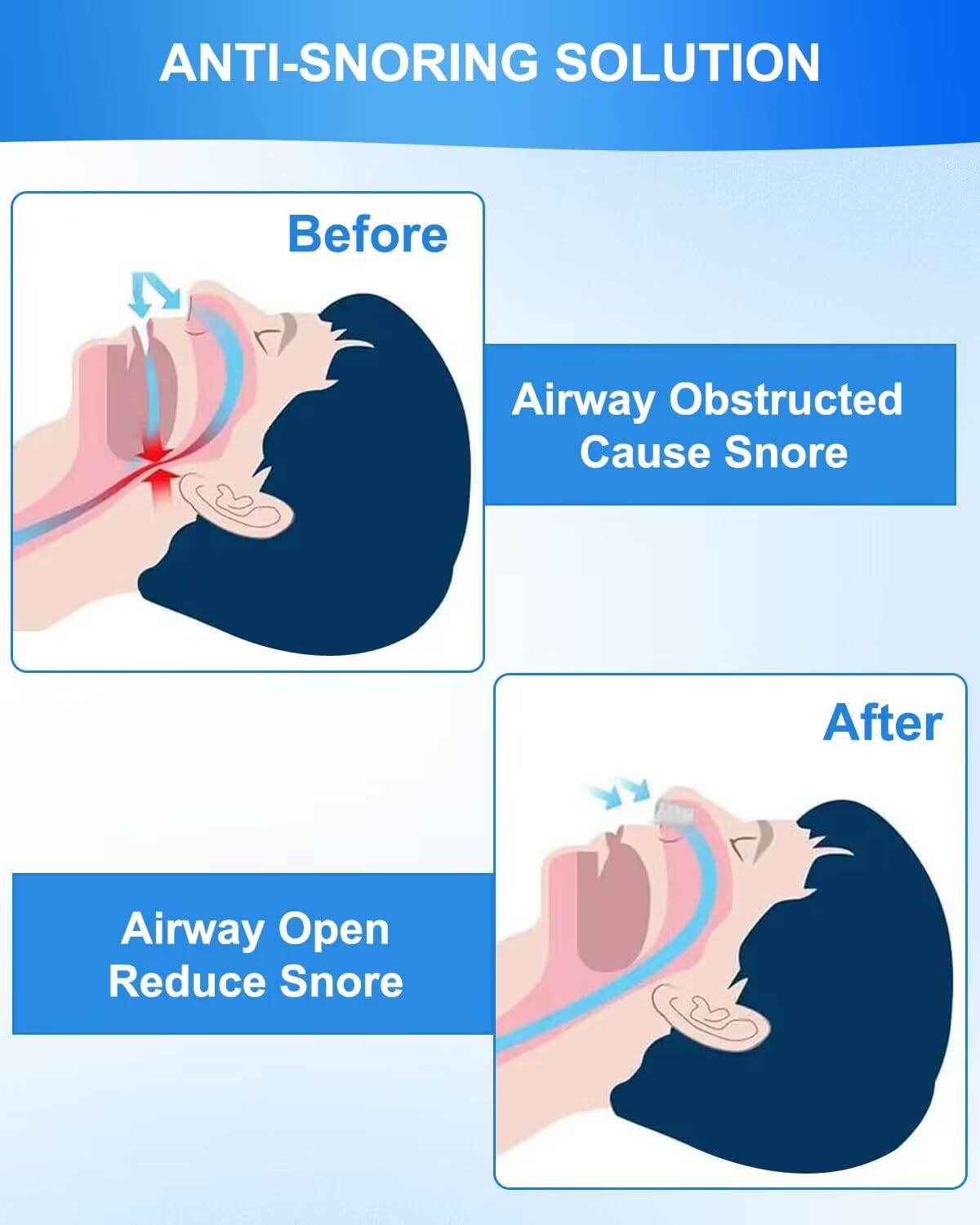mymulike-health-care-schnarchstopper-16-st-ck-anti-schnarch image 6